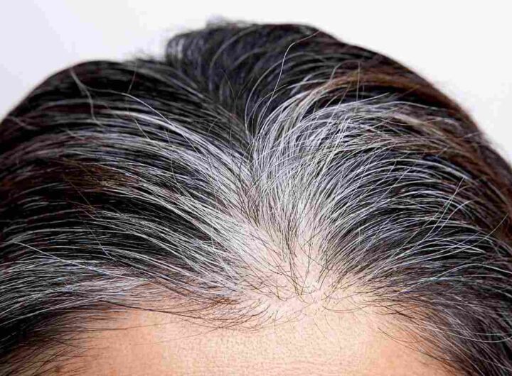 coprire capelli bianchi: 3 trucchi semplici senza tintura